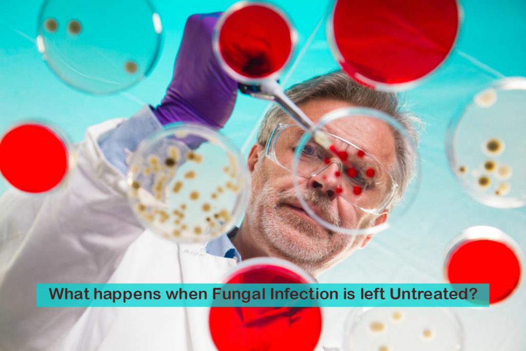 What happens when Fungal Infection is left Untreated?