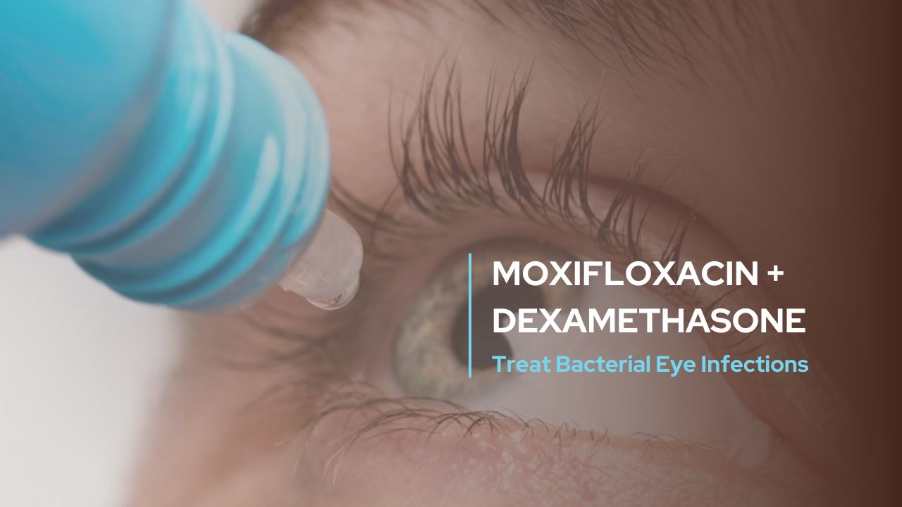 Moxifloxacin + Dexamethasone - Treat Bacterial Eye Infections