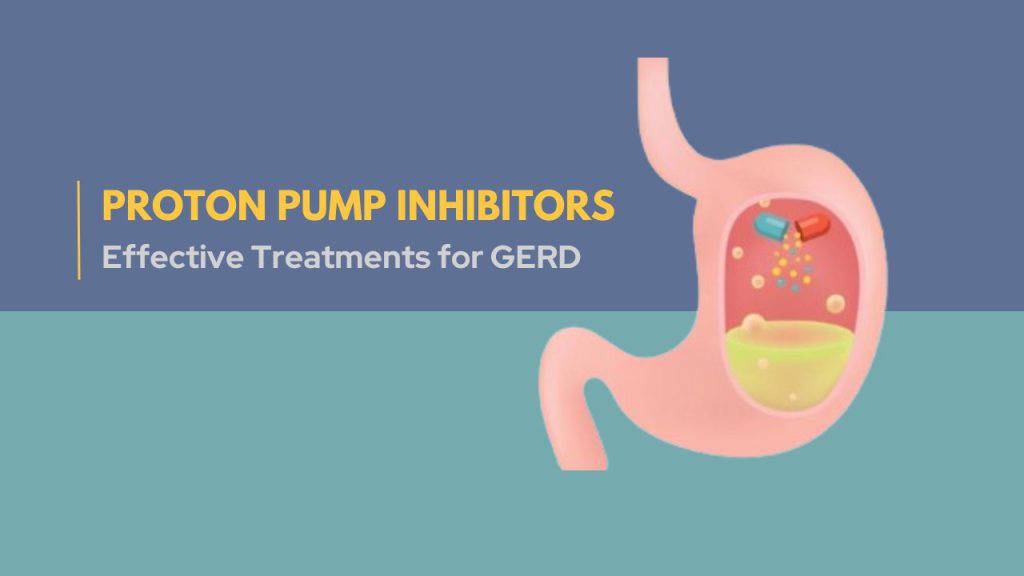 Proton Pump Inhibitors - Effective Treatments for GERD